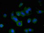 Immunofluorescent analysis of MCF-7 cells using CAC14758 at dilution of 1:100 and Alexa Fluor 488-congugated AffiniPure Goat Anti-Rabbit IgG(H+L) Immunofluorescent analysis of MCF-7 cells using CAC14758 at dilution of 1:100 and Alexa Fluor 488-congugated AffiniPure Goat Anti-Rabbit IgG(H+L)