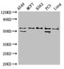 Western Blot, Positive WB detected in: A549 whole cell lysate, MCF-7 whole cell lysate, K562 whole cell lysate, PC-3 whole cell lysate, Rat lung tissue, All lanes: SERPING1 antibody at 2ug/ml, Secondary, Goat polyclonal to rabbit IgG at 1/50000 dilution, Predicted band size: 56, 50 kDa, Observed band size: 56 kDa Western Blot, Positive WB detected in: A549 whole cell lysate, MCF-7 whole cell lysate, K562 whole cell lysate, PC-3 whole cell lysate, Rat lung tissue, All lanes: SERPING1 antibody at 2ug/ml, Secondary, Goat polyclonal to rabbit IgG at 1/50000 dilution, Predicted band size: 56, 50 kDa, Observed band size: 56 kDa