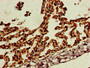 Immunohistochemistry of paraffin-embedded human lung tissue using CAC14761 at dilution of 1:100 Immunohistochemistry of paraffin-embedded human lung tissue using CAC14761 at dilution of 1:100
