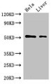Western Blot, Positive WB detected in: Hela whole cell lysate, Rat liver tissue, All lanes: SLC10A3 antibody at 2ug/ml, Secondary, Goat polyclonal to rabbit IgG at 1/50000 dilution, Predicted band size: 51, 48 kDa, Observed band size: 51 kDa Western Blot, Positive WB detected in: Hela whole cell lysate, Rat liver tissue, All lanes: SLC10A3 antibody at 2ug/ml, Secondary, Goat polyclonal to rabbit IgG at 1/50000 dilution, Predicted band size: 51, 48 kDa, Observed band size: 51 kDa