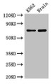 Western Blot, Positive WB detected in: K562 whole cell lysate, Mouse brain tissue, All lanes: SLU7 antibody at 3ug/ml, Secondary, Goat polyclonal to rabbit IgG at 1/50000 dilution, Predicted band size: 69 kDa, Observed band size: 69 kDa Western Blot, Positive WB detected in: K562 whole cell lysate, Mouse brain tissue, All lanes: SLU7 antibody at 3ug/ml, Secondary, Goat polyclonal to rabbit IgG at 1/50000 dilution, Predicted band size: 69 kDa, Observed band size: 69 kDa
