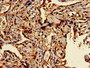 Immunohistochemistry of paraffin-embedded human placenta tissue using CAC14766 at dilution of 1:100 Immunohistochemistry of paraffin-embedded human placenta tissue using CAC14766 at dilution of 1:100