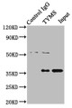 Immunoprecipitating TYMS in Hela whole cell lysate, Lane 1: Rabbit control IgG instead of CAC14768 in Hela whole cell lysate. For western blotting, a HRP-conjugated Protein G antibody was used as the secondary antibody (1/2000), Lane 2: CAC14768 (8ug) + Hela whole cell lysate (500ug), Lane 3: Hela whole cell lysate (10ug) Immunoprecipitating TYMS in Hela whole cell lysate, Lane 1: Rabbit control IgG instead of CAC14768 in Hela whole cell lysate. For western blotting, a HRP-conjugated Protein G antibody was used as the secondary antibody (1/2000), Lane 2: CAC14768 (8ug) + Hela whole cell lysate (500ug), Lane 3: Hela whole cell lysate (10ug)