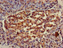 Immunohistochemistry of paraffin-embedded human pancreatic tissue using CAC14771 at dilution of 1:100 Immunohistochemistry of paraffin-embedded human pancreatic tissue using CAC14771 at dilution of 1:100