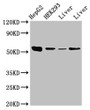 Western Blot, Positive WB detected in: HepG2 whole cell lysate, HEK293 whole cell lysate, Rat liver tissue, Mouse liver tissue, All lanes: MAP2K5 antibody at 3.5ug/ml, Secondary, Goat polyclonal to rabbit IgG at 1/50000 dilution, Predicted band size: 51, 49, 50, 47 kDa, Observed band size: 51 kDa Western Blot, Positive WB detected in: HepG2 whole cell lysate, HEK293 whole cell lysate, Rat liver tissue, Mouse liver tissue, All lanes: MAP2K5 antibody at 3.5ug/ml, Secondary, Goat polyclonal to rabbit IgG at 1/50000 dilution, Predicted band size: 51, 49, 50, 47 kDa, Observed band size: 51 kDa