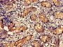 Immunohistochemistry of paraffin-embedded human small intestine tissue using CAC14780 at dilution of 1:100 Immunohistochemistry of paraffin-embedded human small intestine tissue using CAC14780 at dilution of 1:100