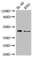 Western Blot, Positive WB detected in: HL60 whole cell lysate, K562 whole cell lysate, All lanes: MTERF1 antibody at 2.6ug/ml, Secondary, Goat polyclonal to rabbit IgG at 1/50000 dilution, Predicted band size: 46 kDa, Observed band size: 46 kDa Western Blot, Positive WB detected in: HL60 whole cell lysate, K562 whole cell lysate, All lanes: MTERF1 antibody at 2.6ug/ml, Secondary, Goat polyclonal to rabbit IgG at 1/50000 dilution, Predicted band size: 46 kDa, Observed band size: 46 kDa