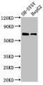 Western Blot, Positive WB detected in: SH-SY5Y whole cell lysate, HepG2 whole cell lysate, All lanes: C7orf31 antibody at 2.5ug/ml, Secondary, Goat polyclonal to rabbit IgG at 1/50000 dilution, Predicted band size: 69 kDa, Observed band size: 69 kDa Western Blot, Positive WB detected in: SH-SY5Y whole cell lysate, HepG2 whole cell lysate, All lanes: C7orf31 antibody at 2.5ug/ml, Secondary, Goat polyclonal to rabbit IgG at 1/50000 dilution, Predicted band size: 69 kDa, Observed band size: 69 kDa
