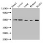 Western Blot, Positive WB detected in: Mouse heart tissue, Mouse liver tissue, Mouse lung tissue, Mouse kidney tissue, Mouse brain tissue, All lanes: GPR22 antibody at 2.5ug/ml, Secondary, Goat polyclonal to rabbit IgG at 1/50000 dilution, Predicted band size: 50 kDa, Observed band size: 50 kDa Western Blot, Positive WB detected in: Mouse heart tissue, Mouse liver tissue, Mouse lung tissue, Mouse kidney tissue, Mouse brain tissue, All lanes: GPR22 antibody at 2.5ug/ml, Secondary, Goat polyclonal to rabbit IgG at 1/50000 dilution, Predicted band size: 50 kDa, Observed band size: 50 kDa