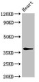 Western Blot, Positive WB detected in: Rat heart tissue, All lanes: MAT2B antibody at 4ug/ml, Secondary, Goat polyclonal to rabbit IgG at 1/50000 dilution, Predicted band size: 38, 37, 29, 35, 10 kDa, Observed band size: 38 kDa