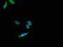 Immunofluorescent analysis of Hela cells using CAC14802 at dilution of 1:100 and Alexa Fluor 488-congugated AffiniPure Goat Anti-Rabbit IgG(H+L) Immunofluorescent analysis of Hela cells using CAC14802 at dilution of 1:100 and Alexa Fluor 488-congugated AffiniPure Goat Anti-Rabbit IgG(H+L)