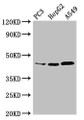 Western Blot, Positive WB detected in: PC-3 whole cell lysate, HepG2 whole cell lysate, A549 whole cell lysate, All lanes: DNMT3L antibody at 3.4ug/ml, Secondary, Goat polyclonal to rabbit IgG at 1/50000 dilution, Predicted band size: 44 kDa, Observed band size: 44 kDa Western Blot, Positive WB detected in: PC-3 whole cell lysate, HepG2 whole cell lysate, A549 whole cell lysate, All lanes: DNMT3L antibody at 3.4ug/ml, Secondary, Goat polyclonal to rabbit IgG at 1/50000 dilution, Predicted band size: 44 kDa, Observed band size: 44 kDa