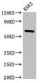 Western Blot, Positive WB detected in: K562 whole cell lysate, All lanes: CDYL antibody at 3ug/ml, Secondary, Goat polyclonal to rabbit IgG at 1/50000 dilution, Predicted band size: 67, 61, 35, 46 kDa, Observed band size: 67 kDa Western Blot, Positive WB detected in: K562 whole cell lysate, All lanes: CDYL antibody at 3ug/ml, Secondary, Goat polyclonal to rabbit IgG at 1/50000 dilution, Predicted band size: 67, 61, 35, 46 kDa, Observed band size: 67 kDa