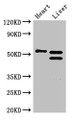 Western Blot, Positive WB detected in: Mouse heart tissue, Mouse liver tissue, All lanes: COQ6 antibody at 3ug/ml, Secondary, Goat polyclonal to rabbit IgG at 1/50000 dilution, predicted band size: 51, 49, 43 kDa, observed band size: 51, 49 kDa Western Blot, Positive WB detected in: Mouse heart tissue, Mouse liver tissue, All lanes: COQ6 antibody at 3ug/ml, Secondary, Goat polyclonal to rabbit IgG at 1/50000 dilution, predicted band size: 51, 49, 43 kDa, observed band size: 51, 49 kDa