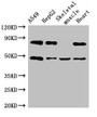 Western Blot, Positive WB detected in: A549 whole cell lysate, HepG2 whole cell lysate, Mouse skeletal muscle tissue, Rat heart tissue, All lanes: ASB4 antibody at 3ug/ml, Secondary, Goat polyclonal to rabbit IgG at 1/50000 dilution, Predicted band size: 49, 39 kDa, Observed band size: 49 kDa