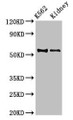 Western Blot, Positive WB detected in: K562 whole cell lysate, Mouse kidney tissue, All lanes: ALDH1A2 antibody at 3.5ug/ml, Secondary, Goat polyclonal to rabbit IgG at 1/50000 dilution, Predicted band size: 57, 54, 55, 47 kDa, Observed band size: 54 kDa Western Blot, Positive WB detected in: K562 whole cell lysate, Mouse kidney tissue, All lanes: ALDH1A2 antibody at 3.5ug/ml, Secondary, Goat polyclonal to rabbit IgG at 1/50000 dilution, Predicted band size: 57, 54, 55, 47 kDa, Observed band size: 54 kDa