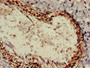 Immunohistochemistry of paraffin-embedded human lung tissue using CAC14811 at dilution of 1:100 Immunohistochemistry of paraffin-embedded human lung tissue using CAC14811 at dilution of 1:100