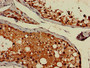 Immunohistochemistry of paraffin-embedded human testis tissue using CAC14813 at dilution of 1:100 Immunohistochemistry of paraffin-embedded human testis tissue using CAC14813 at dilution of 1:100
