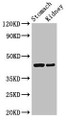 Western Blot, Positive WB detected in: Rat stomach tissue, Mouse kidney tissue, All lanes: CADM3 antibody at 3ug/ml, Secondary, Goat polyclonal to rabbit IgG at 1/50000 dilution, Predicted band size: 44, 48, 39 kDa, Observed band size: 44 kDa Western Blot, Positive WB detected in: Rat stomach tissue, Mouse kidney tissue, All lanes: CADM3 antibody at 3ug/ml, Secondary, Goat polyclonal to rabbit IgG at 1/50000 dilution, Predicted band size: 44, 48, 39 kDa, Observed band size: 44 kDa