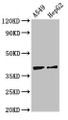 Western Blot, Positive WB detected in: A549 whole cell lysate, HepG2 whole cell lysate, All lanes: CCR10 antibody at 2.7ug/ml, Secondary, Goat polyclonal to rabbit IgG at 1/50000 dilution, Predicted band size: 39 kDa, Observed band size: 39 kDa