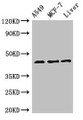 Western Blot, Positive WB detected in: A549 whole cell lysate, MCF-7 whole cell lysate, Rat liver tissue, All lanes: FMOD antibody at 3ug/ml, Secondary, Goat polyclonal to rabbit IgG at 1/50000 dilution, Predicted band size: 44 kDa, Observed band size: 44 kDa