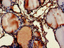 Immunohistochemistry of paraffin-embedded human thyroid tissue using CAC14832 at dilution of 1:100