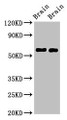 Western Blot, Positive WB detected in: Mouse brain tissue, Rat brain tissue, All lanes: GAS7 antibody at 2.5ug/ml, Secondary, Goat polyclonal to rabbit IgG at 1/50000 dilution, Predicted band size: 55, 48, 40 kDa, Observed band size: 55 kDa Western Blot, Positive WB detected in: Mouse brain tissue, Rat brain tissue, All lanes: GAS7 antibody at 2.5ug/ml, Secondary, Goat polyclonal to rabbit IgG at 1/50000 dilution, Predicted band size: 55, 48, 40 kDa, Observed band size: 55 kDa