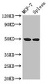 Western Blot, Positive WB detected in: MCF-7 whole cell lysate, Rat spleen tissue, All lanes: HAT1 antibody at 3ug/ml, Secondary, Goat polyclonal to rabbit IgG at 1/50000 dilution, Predicted band size: 50, 40 kDa, Observed band size: 50 kDa Western Blot, Positive WB detected in: MCF-7 whole cell lysate, Rat spleen tissue, All lanes: HAT1 antibody at 3ug/ml, Secondary, Goat polyclonal to rabbit IgG at 1/50000 dilution, Predicted band size: 50, 40 kDa, Observed band size: 50 kDa