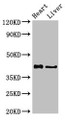 Western Blot, Positive WB detected in: Rat heart tissue, Rat liver tissue, All lanes: HDAC8 antibody at 2.5ug/ml, Secondary, Goat polyclonal to rabbit IgG at 1/50000 dilution, Predicted band size: 42, 30, 18, 32, 29, 16, 17 kDa, Observed band size: 42 kDa Western Blot, Positive WB detected in: Rat heart tissue, Rat liver tissue, All lanes: HDAC8 antibody at 2.5ug/ml, Secondary, Goat polyclonal to rabbit IgG at 1/50000 dilution, Predicted band size: 42, 30, 18, 32, 29, 16, 17 kDa, Observed band size: 42 kDa