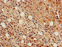 Immunohistochemistry of paraffin-embedded human adrenal gland tissue using CAC14847 at dilution of 1:100 Immunohistochemistry of paraffin-embedded human adrenal gland tissue using CAC14847 at dilution of 1:100