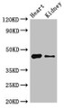 Western Blot, Positive WB detected in: Mouse heart tissue, Mouse kidney tissue, All lanes: MNDA antibody at 4ug/ml, Secondary, Goat polyclonal to rabbit IgG at 1/50000 dilution, Predicted band size: 46 kDa, Observed band size: 46 kDa Western Blot, Positive WB detected in: Mouse heart tissue, Mouse kidney tissue, All lanes: MNDA antibody at 4ug/ml, Secondary, Goat polyclonal to rabbit IgG at 1/50000 dilution, Predicted band size: 46 kDa, Observed band size: 46 kDa