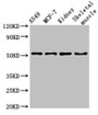 Western Blot, Positive WB detected in: A549 whole cell lysate, MCF-7 whole cell lysate, Mouse kidney tissue, Mouse skeletal muscle tissue, All lanes: NARF antibody at 3ug/ml, Secondary, Goat polyclonal to rabbit IgG at 1/50000 dilution, Predicted band size: 52, 57, 46, 45 kDa, Observed band size: 52 kDa Western Blot, Positive WB detected in: A549 whole cell lysate, MCF-7 whole cell lysate, Mouse kidney tissue, Mouse skeletal muscle tissue, All lanes: NARF antibody at 3ug/ml, Secondary, Goat polyclonal to rabbit IgG at 1/50000 dilution, Predicted band size: 52, 57, 46, 45 kDa, Observed band size: 52 kDa