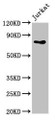 Western Blot, Positive WB detected in: Jurkat whole cell lysate, All lanes: PIK3R2 antibody at 4ug/ml, Secondary, Goat polyclonal to rabbit IgG at 1/50000 dilution, Predicted band size: 82 kDa, Observed band size: 82 kDa Western Blot, Positive WB detected in: Jurkat whole cell lysate, All lanes: PIK3R2 antibody at 4ug/ml, Secondary, Goat polyclonal to rabbit IgG at 1/50000 dilution, Predicted band size: 82 kDa, Observed band size: 82 kDa
