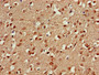 Immunohistochemistry of paraffin-embedded human brain tissue using CAC14872 at dilution of 1:100