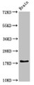 Western Blot, Positive WB detected in: Rat brain tissue, All lanes: RPL23A antibody at 3ug/ml, Secondary, Goat polyclonal to rabbit IgG at 1/50000 dilution, Predicted band size: 18 kDa, Observed band size: 18 kDa Western Blot, Positive WB detected in: Rat brain tissue, All lanes: RPL23A antibody at 3ug/ml, Secondary, Goat polyclonal to rabbit IgG at 1/50000 dilution, Predicted band size: 18 kDa, Observed band size: 18 kDa