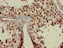 Immunohistochemistry of paraffin-embedded human testis tissue using CAC14877 at dilution of 1:100 Immunohistochemistry of paraffin-embedded human testis tissue using CAC14877 at dilution of 1:100