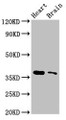 Western Blot, Positive WB detected in: Mouse heart tissue, Mouse brain tissue, All lanes: SRR antibody at 3ug/ml, Secondary, Goat polyclonal to rabbit IgG at 1/50000 dilution, Predicted band size: 37 kDa, Observed band size: 37 kDa