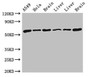 Western Blot, Positive WB detected in: A549 whole cell lysate, Hela whole cell lysate, Rat brain tissue, Rat liver tissue, Mouse liver tissue, Mouse brain tissue, All lanes: TH antibody at 4ug/ml, Secondary, Goat polyclonal to rabbit IgG at 1/50000 dilution, Predicted band size: 59, 56, 57, 46, 45 kDa, Observed band size: 59 kDa
