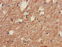 Immunohistochemistry of paraffin-embedded human brain tissue using CAC14884 at dilution of 1:100