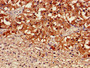 Immunohistochemistry of paraffin-embedded human adrenal gland tissue using CAC14884 at dilution of 1:100