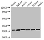 Western Blot, Positive WB detected in: Rat heart tissue, Rat spleen tissue, Mouse heart tissue, Mouse liver tissue, Mouse kidney tissue, Mouse brain tissue, All lanes: VEGFB antibody at 3.5ug/ml, Secondary, Goat polyclonal to rabbit IgG at 1/50000 dilution, Predicted band size: 22 kDa, Observed band size: 28 kDa