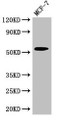 Western Blot, Positive WB detected in: MCF-7 whole cell lysate, All lanes: CYP51A1 antibody at 2.7ug/ml, Secondary, Goat polyclonal to rabbit IgG at 1/50000 dilution, Predicted band size: 57, 47 kDa, Observed band size: 57 kDa