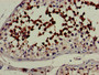 Immunohistochemistry of paraffin-embedded human testis tissue using CAC14891 at dilution of 1:100