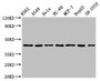 Western Blot, Positive WB detected in: K562 whole cell lysate, A549 whole cell lysate, Hela whole cell lysate, HL60 whole cell lyasate, MCF-7 whole cell lysate, HepG2 whole cell lysate, SH-SY5Y whole cell lysate, All lanes: TARDBP antibody at 2.5ug/ml, Secondary, Goat polyclonal to rabbit IgG at 1/50000 dilution, Predicted band size: 45, 32 kDa, Observed band size: 45 kDa