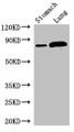 Western Blot, Positive WB detected in: Mouse stomach tissue, Rat lung tissue, All lanes: SLC3A1 antibody at 2.8ug/ml, Secondary, Goat polyclonal to rabbit IgG at 1/50000 dilution, Predicted band size: 79, 47, 46, 36, 58, 67, 64 kDa, Observed band size: 79 kDa Western Blot, Positive WB detected in: Mouse stomach tissue, Rat lung tissue, All lanes: SLC3A1 antibody at 2.8ug/ml, Secondary, Goat polyclonal to rabbit IgG at 1/50000 dilution, Predicted band size: 79, 47, 46, 36, 58, 67, 64 kDa, Observed band size: 79 kDa