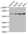 Western Blot, Positive WB detected in: NIH/3T3 whole cell lysate, HepG2 whole cell lysate, Mouse brain tissue, Rat heart tissue, All lanes: EMB antibody at 3ug/ml, Secondary, Goat polyclonal to rabbit IgG at 1/50000 dilution, Predicted band size: 37, 32 kDa, Observed band size: 70 kDa Western Blot, Positive WB detected in: NIH/3T3 whole cell lysate, HepG2 whole cell lysate, Mouse brain tissue, Rat heart tissue, All lanes: EMB antibody at 3ug/ml, Secondary, Goat polyclonal to rabbit IgG at 1/50000 dilution, Predicted band size: 37, 32 kDa, Observed band size: 70 kDa