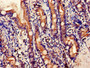Immunohistochemistry of paraffin-embedded human small intestine tissue using CAC14904 at dilution of 1:100 Immunohistochemistry of paraffin-embedded human small intestine tissue using CAC14904 at dilution of 1:100
