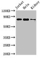 Western Blot, Positive WB detected in: Jurkat whole cell lysate, Hela whole cell lysate, Mouse kidney tissue, All lanes: NOA1 antibody at 3.4ug/ml, Secondary, Goat polyclonal to rabbit IgG at 1/50000 dilution, Predicted band size: 79 kDa, Observed band size: 79 kDa Western Blot, Positive WB detected in: Jurkat whole cell lysate, Hela whole cell lysate, Mouse kidney tissue, All lanes: NOA1 antibody at 3.4ug/ml, Secondary, Goat polyclonal to rabbit IgG at 1/50000 dilution, Predicted band size: 79 kDa, Observed band size: 79 kDa