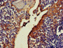 IHC image of CAC14911 diluted at 1:500 and staining in paraffin-embedded human tonsil tissue performed on a Leica BondTM system. After dewaxing and hydration, antigen retrieval was mediated by high pressure in a citrate buffer (pH 6.0). Section was blocked with 10% normal goat serum 30min at RT. Then primary antibody (1% BSA) was incubated at 4°C overnight. The primary is detected by a biotinylated secondary antibody and visualized using an HRP conjugated SP system. IHC image of CAC14911 diluted at 1:500 and staining in paraffin-embedded human tonsil tissue performed on a Leica BondTM system. After dewaxing and hydration, antigen retrieval was mediated by high pressure in a citrate buffer (pH 6.0). Section was blocked with 10% normal goat serum 30min at RT. Then primary antibody (1% BSA) was incubated at 4°C overnight. The primary is detected by a biotinylated secondary antibody and visualized using an HRP conjugated SP system.