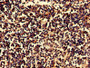 IHC image of CAC14914 diluted at 1:800 and staining in paraffin-embedded human spleen tissue performed on a Leica BondTM system. After dewaxing and hydration, antigen retrieval was mediated by high pressure in a citrate buffer (pH 6.0). Section was blocked with 10% normal goat serum 30min at RT. Then primary antibody (1% BSA) was incubated at 4°C overnight. The primary is detected by a biotinylated secondary antibody and visualized using an HRP conjugated SP system.